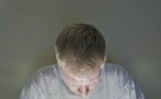 Hair loss essay picture