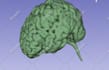 convert your ct or mri scans to 3d printable file