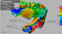 convert medical dicom images to stl and 3d printable models
