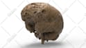 convert medical dicom images to stl and 3d printable models