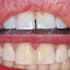 refine cosmetic or dental photos to make great posts