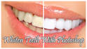 do teeth whitening and teeth fixing in 2 hours