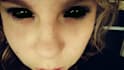 make black eye or any eye effects