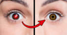 remove red eye from your picture and do photo retouch