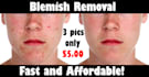 remove acne and scars from your photos