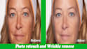 retouch your photo and remove wrinkle with photoshop