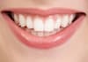 answer a dental question