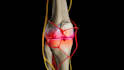 create professional 3d medical animation and moa videos