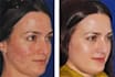 do high end beauty retouching and advanced retouching