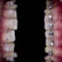 refine cosmetic or dental photos to make great posts