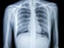 a second opinion on any radiology scan mri, xray, ct, US
