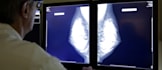 expert opinion as a radiologist on xray mri ct scan
