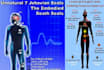 remove jseals and unnatural implants