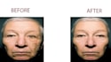 image restore, enhance, fix picture, resizing and bg remove