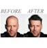 make hair on the bald head
