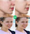 retouch image, remove acne, pimples, wrinkles, and blemishes