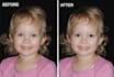 red eye removal, skin retouching and teeth whitening