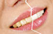 whiten your teeth in 3 pictures