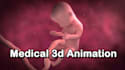 create medical 3d animation video