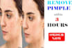 remove wrinkles,  blemishes, spots, pimples from face