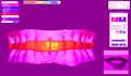 design michigan splints and retainers