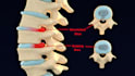 create 3d medical animation and illustration