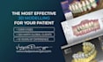 do dental prosthesis crown design using exocad, 3shape, inlab and cerec