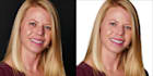 do headshot retouch , skin retouching , retouch quickly