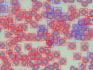 do computer vision deep learning tasks with python