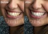 edit and retouch your portrait, headshot, or family photos