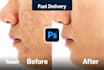 remove wrinkles, blemishes, dark circles, unwanted spots
