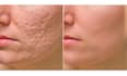 do professional photo editing and retouching
