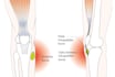 design scientific, medical, educational illustration redraw