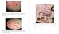 technical reports on parasitology