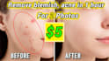 remove blemish, acne, pimple, freckle, wrinkles,skin retouch