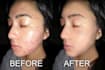 retouch your photo