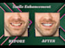 edit your teeth using photoshop fast delivery
