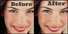 turn your smile into a perfect white smile
