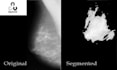 do image preprocessing and neural network training