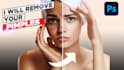remove your 15 image pimples and brightens it within 1 day