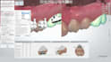 plan your orthodontic bracket positioning case