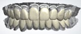 do waxup mockup and monolithic zirconia design using 3shape