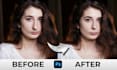 professionally reshape your nose and enhance your face naturally