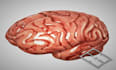create realistic 3d medical animation, 3d animation and 3d medical device video