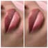 do retouching after cosmetic procedures