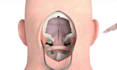 create 3d medical animation video,3d animation, 2d 3d animation video, surgery