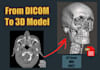 create a 3d model from your ct or mri dicoms