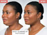 do body face slimming, remove double chin and retouching