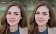 quickly remove pimples marks and dark spots, acne, from face