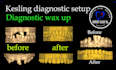 design kesling diagnostic setup